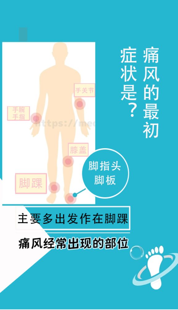 痛风页